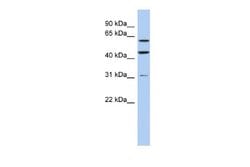 ZNF179 Rabbit anti-Human, Polyclonal, Novus Biologicals 0.1 mL | Buy Online | Novus Biologicals | Fisher Scientific